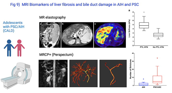 Assessment of Noninvasive MRI-based Biomarkers of Hepatobiliary Fibrosis in Autoimmune Liver Disease Patients
